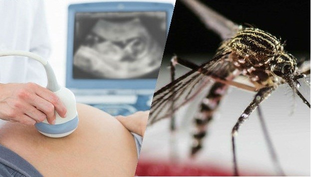 Novo otkriće: Zika u u kasnoj trudnoći ne uzrokuje poremećaje beba